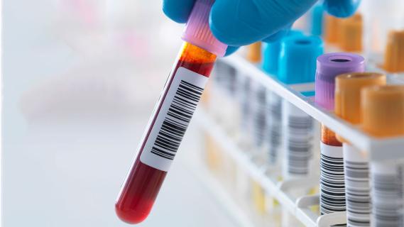 Growth Of The Rheumatoid Arthritis Diagnostic Tests Market logo