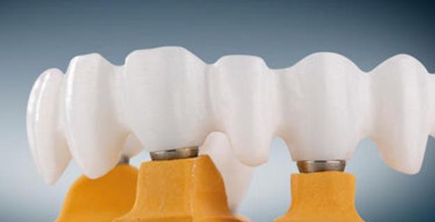 Growth of Zirconia Based Dental Materials Market logo